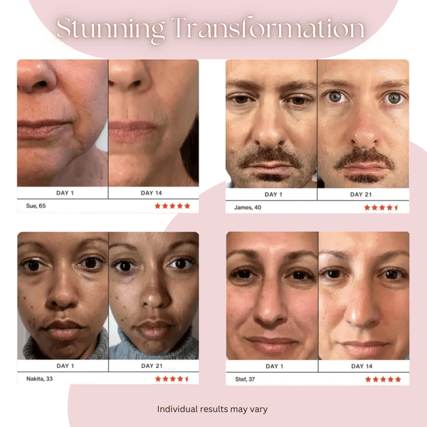 GlowLift | Transform Your Skin's Radiance